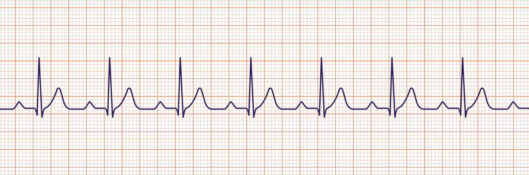 ACLS-Figure-25