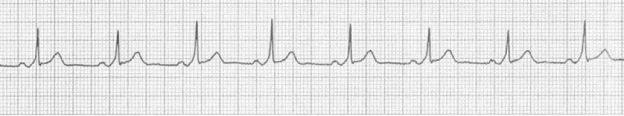 True or False - Question 2 - ACLS Medical Training