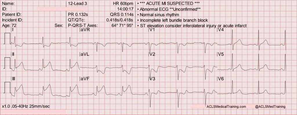 2015 Aha Ecc Guidelines - Part 1 - Acls Medical Training