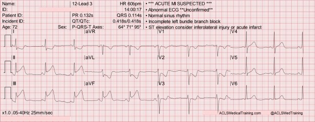 2015 AHA ECC Guidelines - Part 1 - ACLS Medical Training