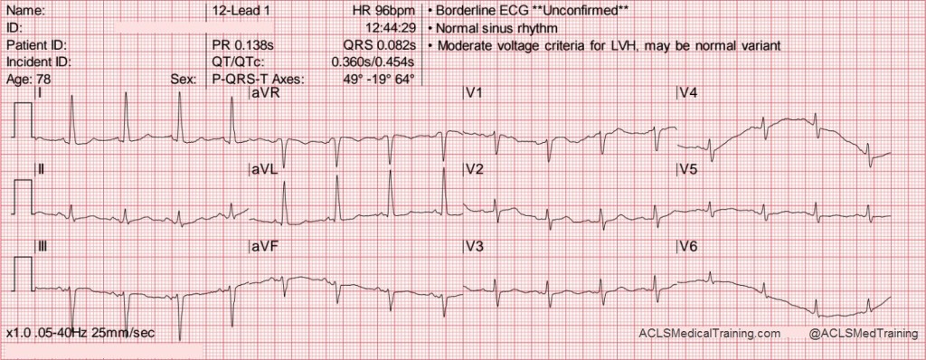 wandering definition in medical